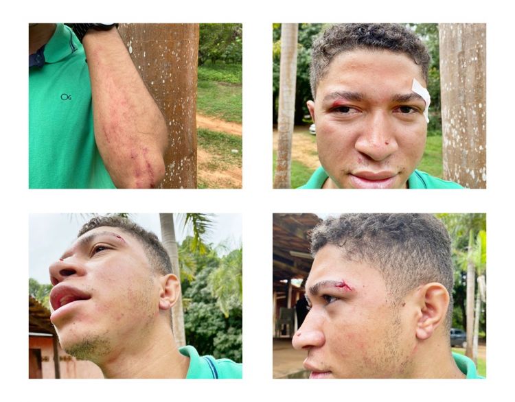 AÇAILÂNDIA - Funcionário da Caixa Econômica Federal é chamado de ladrão e agredido na porta de casa, por casal.